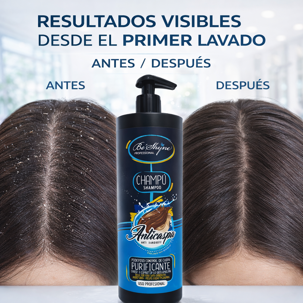 Be´Shyne® – Champú Anticaspa purificante con aloe vera 1L