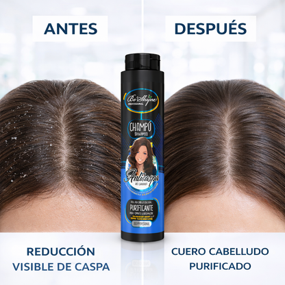 Be’Shyne® – Champú Anticaspa Purificante con Aloe Vera y Soja 500ml