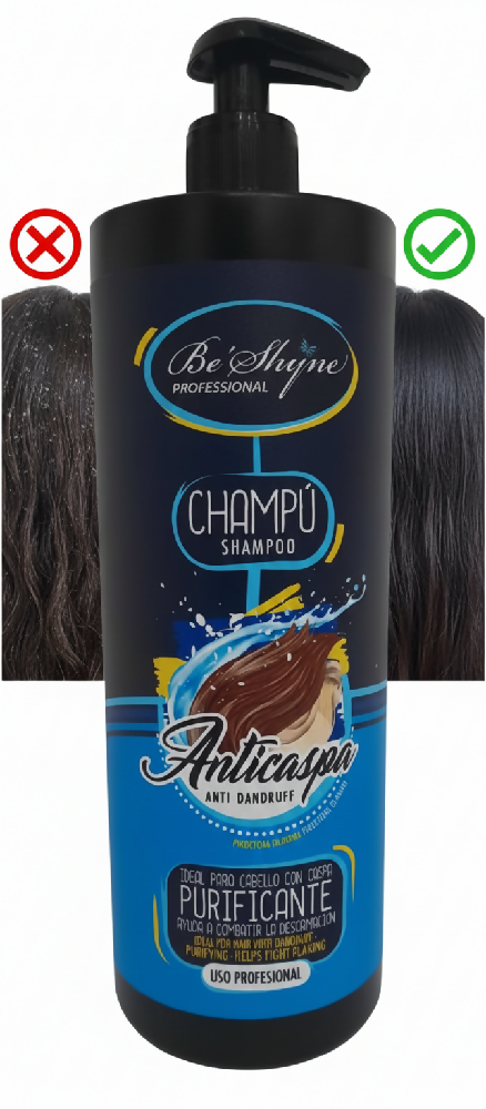 Be´Shyne®, Champú Anticaspa 1l.
